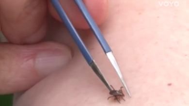 Photo of VIDEO Liječnica otkrila kako ukloniti krpelja i ne napraviti štetu: Neke stvari nemojte raditi!